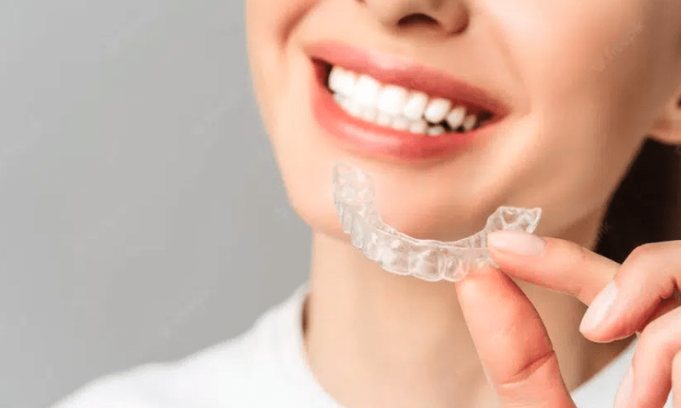 Beyond Braces: Discover the Best Invisible Aligners of 2025
