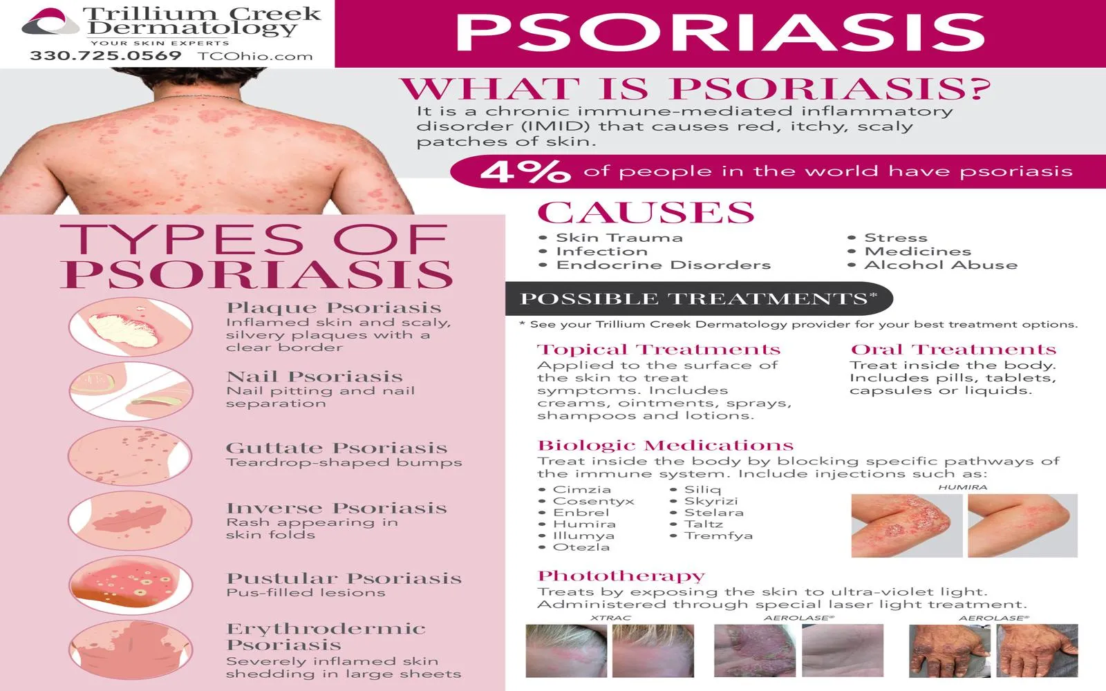 Best Treatment Options for Psoriasis That Actually Help