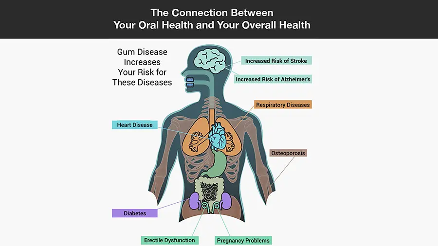 How Dental Health Affects Overall Health and How to Improve Dental Health